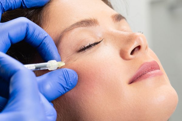 botox-injections-crows-feet botox-injections-crows-feet